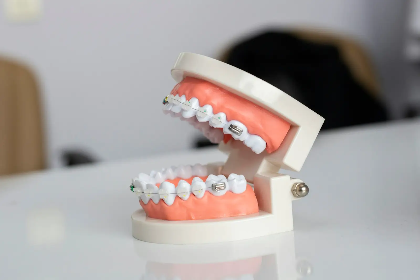 Modèle de dentition avec appareil orthodontique